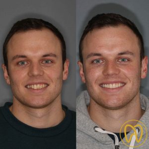 James Brooks before and Afters
