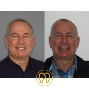 Mark Abbott before and after profile with logo