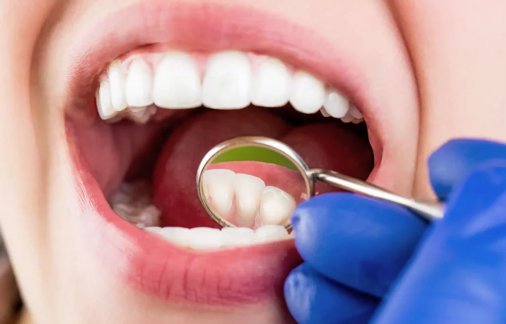Dental Examination
